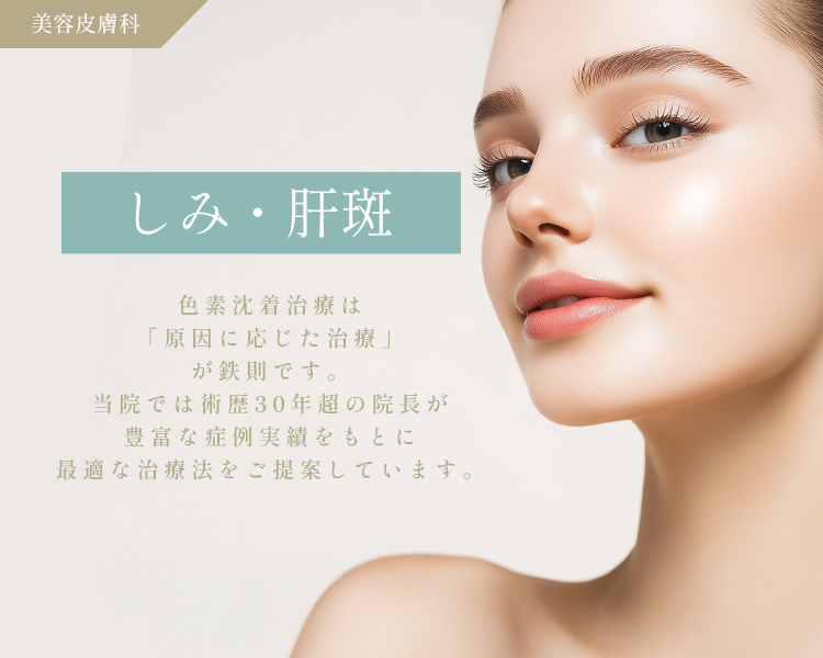 シミ取りレーザー・肝斑治療 | 種類・値段・効果・痛み・経過について