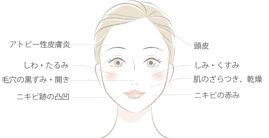 ACRS注入療法がお勧めの部位