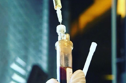 ACRS注入療法について