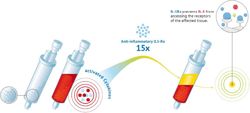 炎症を抑える作用がある「抗炎症性サイトカイン」