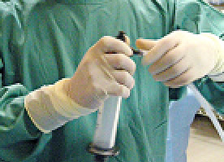 専用シリンジで脂肪を摂取