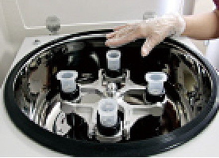 摂取した脂肪を遠心力分離