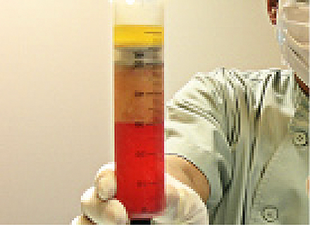 脂肪が三層に分かれる