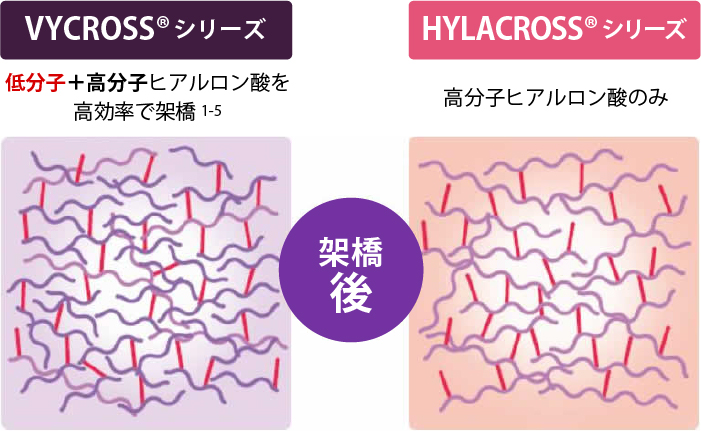 アラガン社独自の特許技術「*VYCROSSバイクロス」について