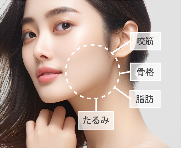 咬筋が原因のエラ張りに適応
