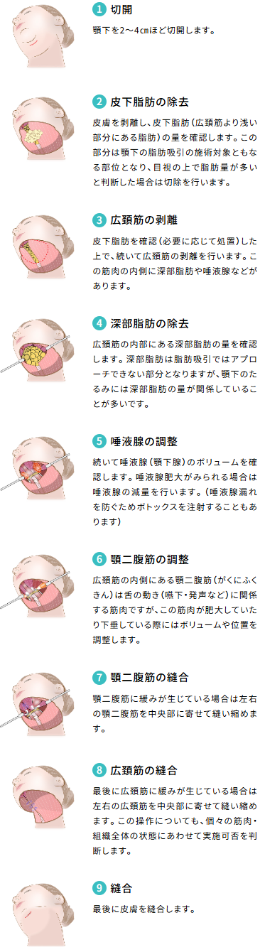 ペリカン手術の流れ