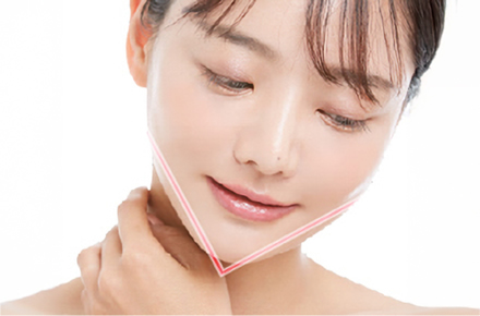 プロテーゼ・脂肪注入