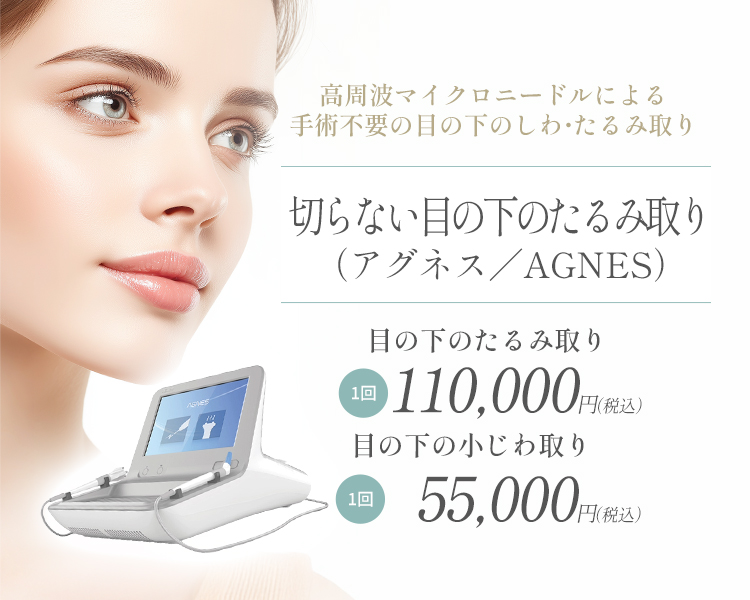 アグネス（切らない目の下のたるみ取り）