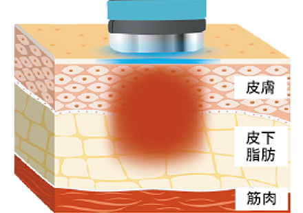 脂肪減少作用