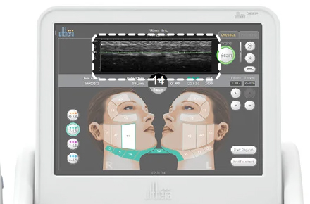 「DeepSEE技術」による精密で安全な照射