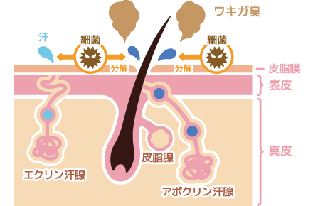 ワキガの原因