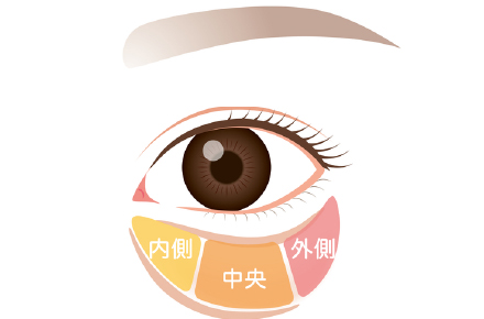 眼窩脂肪は皮下で3つのパーツに分かれている