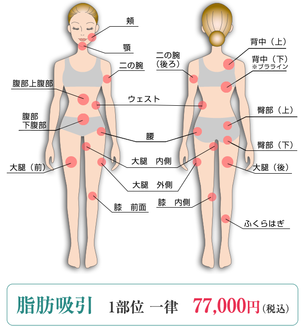 みずほクリニックの脂肪吸引適用範囲