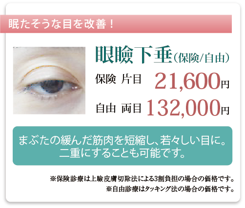 目瞼下垂