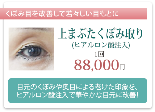 上まぶたくぼみ取り
