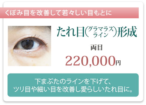 たれ目（グラマラスライン）形成