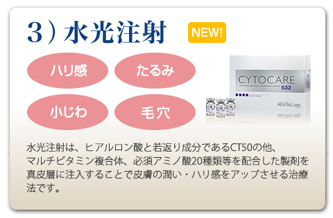 ヒアルロン酸注入