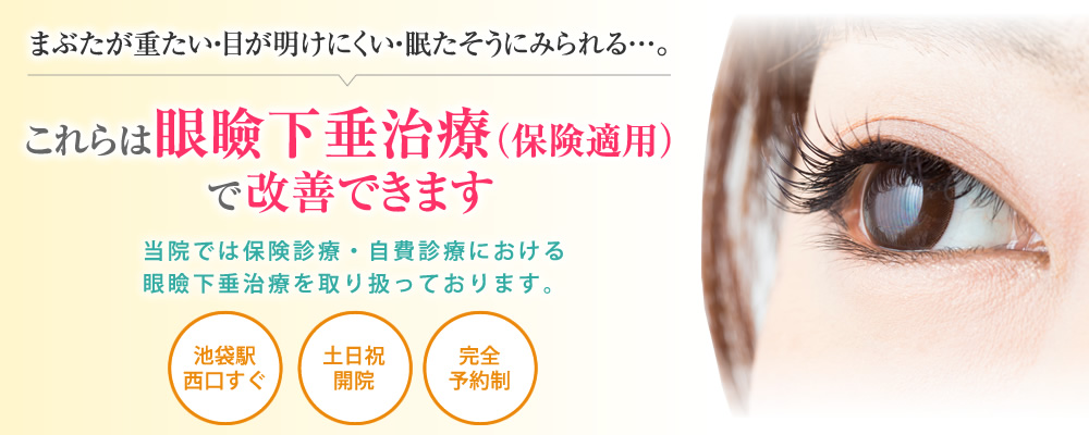 眼瞼下垂治療