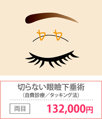 切らない眼瞼下垂術