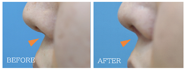 猫手術の症例写真