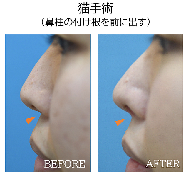 猫手術の症例写真