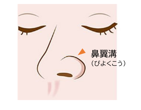 鼻翼溝とは